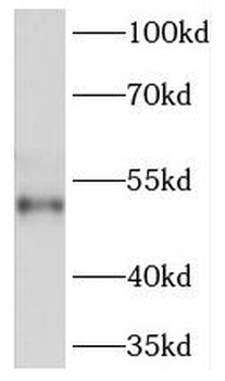 PRKACB Antibody