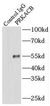 PRKACB Rabbit Polyclonal Antibody