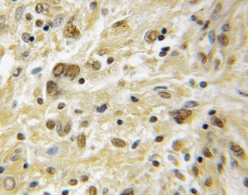 PRKACB Rabbit Polyclonal Antibody