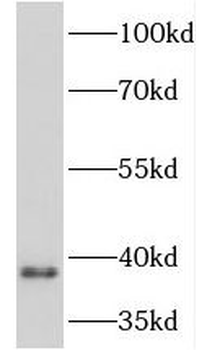 CAVIN3 Rabbit Polyclonal Antibody