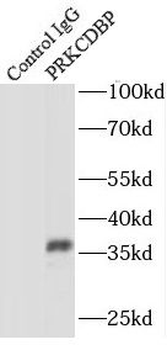 CAVIN3 Rabbit Polyclonal Antibody