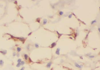 CAVIN3 Rabbit Polyclonal Antibody