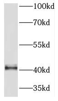 PRMT1 Antibody