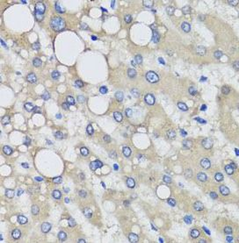 PRODH Rabbit Polyclonal Antibody