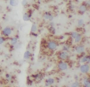 PROS1 Rabbit Polyclonal Antibody