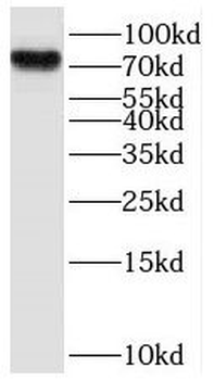 LZTS3 Antibody