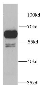 PRPF19 Antibody