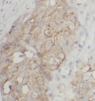 PRR13 Rabbit Polyclonal Antibody