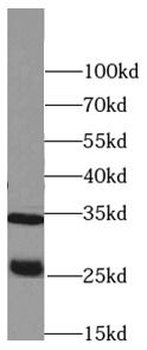 PRSS2 Rabbit Polyclonal Antibody