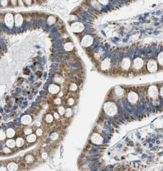 PRSS2 Rabbit Polyclonal Antibody