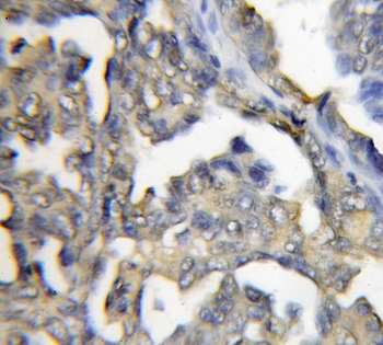 PRTFDC1 Rabbit Polyclonal Antibody