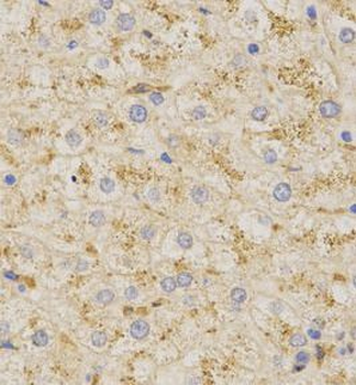 PSAP Rabbit Polyclonal Antibody