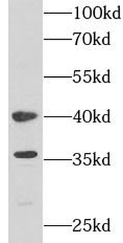 PSAT1 Antibody