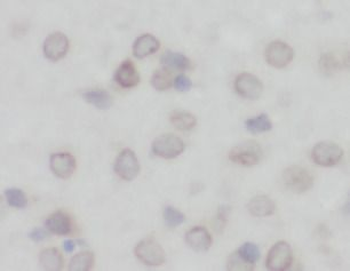 DLG4 Specific Rabbit Polyclonal Antibody