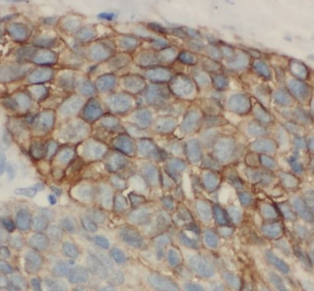 SELP Rabbit Polyclonal Antibody