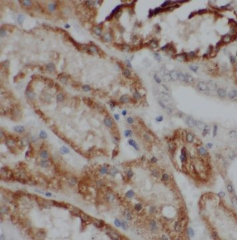 PSKH2 Rabbit Polyclonal Antibody