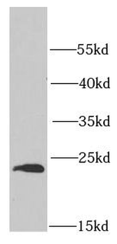 PSMB1 Antibody