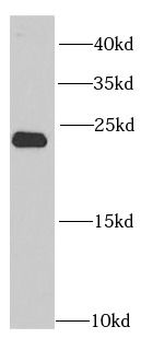 PSMB2 Antibody