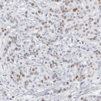 PSMB4 Rabbit Polyclonal Antibody