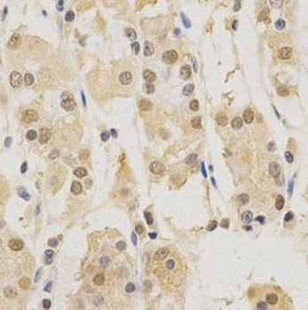PSMB5 Rabbit Polyclonal Antibody