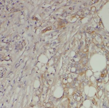 PSMB6 Rabbit Polyclonal Antibody