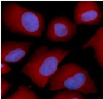 PSMC4 Rabbit Polyclonal Antibody