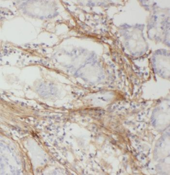 PSMC4 Rabbit Polyclonal Antibody
