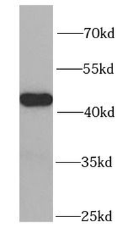 PSMC6 Antibody