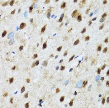 PSMD13 Rabbit Polyclonal Antibody