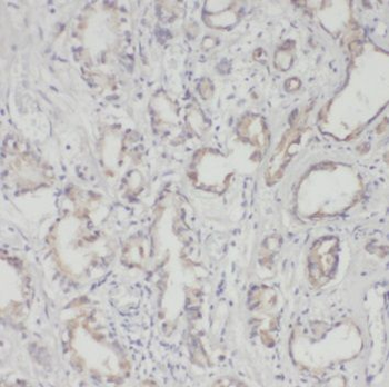 PSMD5 Rabbit Polyclonal Antibody