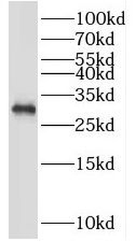 PSME3 Antibody