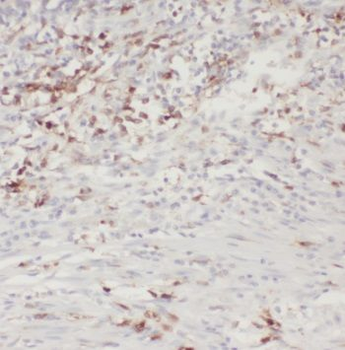 PSME3 Rabbit Polyclonal Antibody
