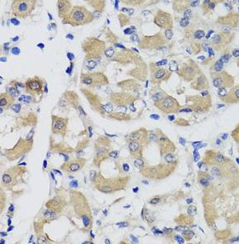 PSPH Rabbit Polyclonal Antibody