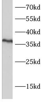 PSTPIP2 Antibody