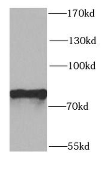 PTCD3 Rabbit Polyclonal Antibody