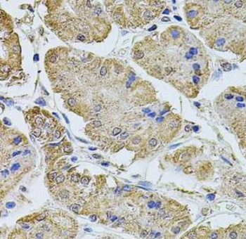 PTCD3 Rabbit Polyclonal Antibody