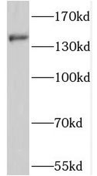 PTCH2 Antibody