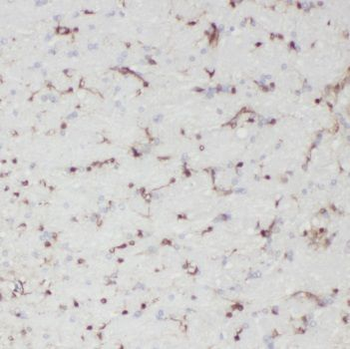 PTCH2 Rabbit Polyclonal Antibody