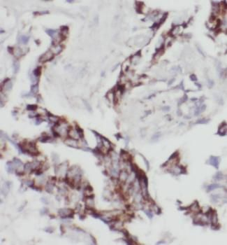 PTEN Mouse Monoclonal Antibody