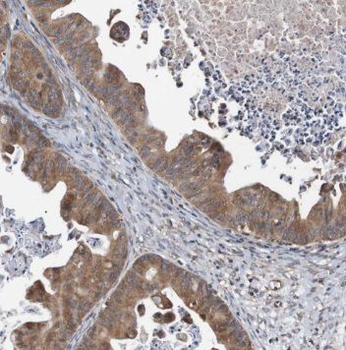PTER Rabbit Polyclonal Antibody