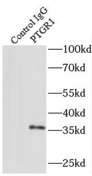 PTGR1 Rabbit Polyclonal Antibody