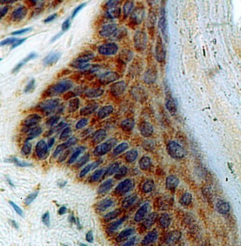 RMDN3 Rabbit Polyclonal Antibody