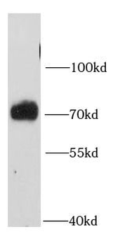 PTPN11 Rabbit Polyclonal Antibody