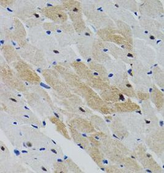 PTPN11 Rabbit Polyclonal Antibody