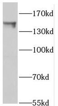 PTPN14 Antibody