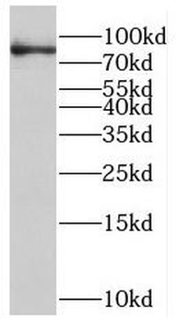PTPN22 Rabbit Polyclonal Antibody