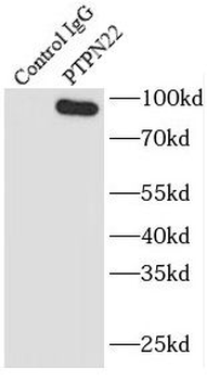 PTPN22 Rabbit Polyclonal Antibody