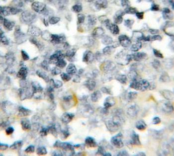 PTPN22 Rabbit Polyclonal Antibody