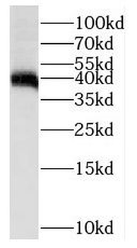 PTPN7 Rabbit Polyclonal Antibody