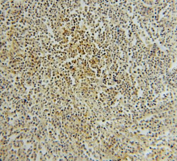 PTPN7 Rabbit Polyclonal Antibody